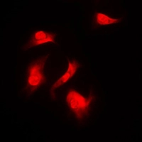 ICC/IF analysis of formalin-fixed HeLa cells using GTX32258 p70 S6K (phospho Ser418) antibody. Red : Primary antibody Blue : DAPI Permeabilization : 0.1% Triton X-100 in TBS for 5-10 minutes ICC/IF analysis of formalin-fixed HeLa cells using GTX32258 p70 S6K (phospho Ser418) antibody. Red : Primary antibody Blue : DAPI Permeabilization : 0.1% Triton X-100 in TBS for 5-10 minutes