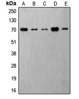 WB analysis of insulin-treated MDA-MB-231 (A), Jurkat (B), HeLa (C), NIH3T3 (D), PC12 (E) whole cell lysates using GTX32259 p70 S6K (phospho Thr421) antibody.