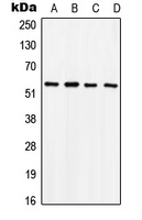 WB analysis of PMA-treated HeLa (A), SW480 (B), mouse brain (C), rat liver (D) whole cell lysates using GTX32262 SOX9 (phospho Ser181) antibody. WB analysis of PMA-treated HeLa (A), SW480 (B), mouse brain (C), rat liver (D) whole cell lysates using GTX32262 SOX9 (phospho Ser181) antibody.