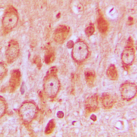 IHC-P analysis of formalin fixed human brain tissue section using GTX32263 Src (phospho Ser75) antibody. Antigen retrieval : Heat mediated antigen retrieval with sodium citrate buffer (pH 6.0) IHC-P analysis of formalin fixed human brain tissue section using GTX32263 Src (phospho Ser75) antibody. Antigen retrieval : Heat mediated antigen retrieval with sodium citrate buffer (pH 6.0)