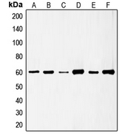 WB analysis of HeLa (A), HUVEC (B), Jurkat (C), COLO205 (D), EGF-treated HEK293T (E), pervanadate-treated A431 (F) whole cell lysates using GTX32263 Src (phospho Ser75) antibody.