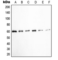 WB analysis of K562 (A), HUVEC (B), Jurkat (C), COLO205 (D), EGF-treated HEK293T (E), pervanadate-treated A431 (F) whole cell lysates using GTX32265 Src (phospho Tyr527) antibody.