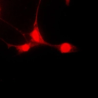 ICC/IF analysis of formalin-fixed HepG2 cells using GTX32268 STAT5A (phospho Ser780) antibody. Red : Primary antibody Blue : DAPI Permeabilization : 0.1% Triton X-100 in TBS for 5-10 minutes ICC/IF analysis of formalin-fixed HepG2 cells using GTX32268 STAT5A (phospho Ser780) antibody. Red : Primary antibody Blue : DAPI Permeabilization : 0.1% Triton X-100 in TBS for 5-10 minutes