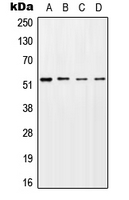 WB analysis of UV-treated HeLa (A), UV-treated NIH3T3 (B), mouse brain (C), UV-treated PC12 (D) whole cell lysates using GTX32269 LKB1 (phospho Ser428) antibody. WB analysis of UV-treated HeLa (A), UV-treated NIH3T3 (B), mouse brain (C), UV-treated PC12 (D) whole cell lysates using GTX32269 LKB1 (phospho Ser428) antibody.