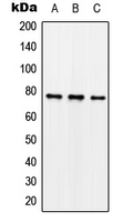 WB analysis of nocodazole-treated SK-N-SH (A), mouse brain (B), rat brain (C) whole cell lysates using GTX32272 Synapsin I (phospho Ser62) antibody. WB analysis of nocodazole-treated SK-N-SH (A), mouse brain (B), rat brain (C) whole cell lysates using GTX32272 Synapsin I (phospho Ser62) antibody.