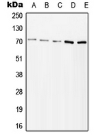 WB analysis of H2O2-treated Jurkat (A), H2O2-treated HeLa (B), lambda phosphatase-treated Ramos (C), mouse kidney (D), rat kidney (E) whole cell lysates using GTX32280 ZAP70 (phospho Tyr315) antibody. WB analysis of H2O2-treated Jurkat (A), H2O2-treated HeLa (B), lambda phosphatase-treated Ramos (C), mouse kidney (D), rat kidney (E) whole cell lysates using GTX32280 ZAP70 (phospho Tyr315) antibody.