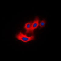 ICC/IF analysis of formalin-fixed Raw264.7 cells using GTX32289 PAK4 (phospho Ser474) / PAK5 (phospho Ser602) / PAK6 (phospho Ser560) antibody. Red : Primary antibody Blue : DAPI Permeabilization : 0.1% Triton X-100 in TBS for 5-10 minutes ICC/IF analysis of formalin-fixed Raw264.7 cells using GTX32289 PAK4 (phospho Ser474) / PAK5 (phospho Ser602) / PAK6 (phospho Ser560) antibody. Red : Primary antibody Blue : DAPI Permeabilization : 0.1% Triton X-100 in TBS for 5-10 minutes