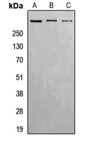 WB analysis of Hela (A), Raw264.7 (B), H9C2 (C) whole cell lysates using GTX32295 ATM (phospho Ser1981) antibody. WB analysis of Hela (A), Raw264.7 (B), H9C2 (C) whole cell lysates using GTX32295 ATM (phospho Ser1981) antibody.