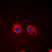 ICC/IF analysis of formalin-fixed HeLa cells using GTX32326 Cortactin (phospho Tyr466) antibody. Red : Primary antibody Blue : DAPI Permeabilization : 0.1% Triton X-100 in TBS for 5-10 minutes ICC/IF analysis of formalin-fixed HeLa cells using GTX32326 Cortactin (phospho Tyr466) antibody. Red : Primary antibody Blue : DAPI Permeabilization : 0.1% Triton X-100 in TBS for 5-10 minutes