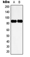 WB analysis of UV-treated HeLa (A), H2O2-treated NIH3T3 (B) whole cell lysates using GTX32326 Cortactin (phospho Tyr466) antibody.