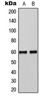 WB analysis of EGF-treated A431 (A), HL60 TGF-treated (B) whole cell lysates using GTX32335 SMAD3 (phospho Ser425) antibody.