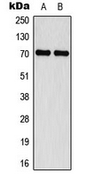 WB analysis of IFN-treated MCF7 (A), IFN-treated Jurkat (B) whole cell lysates using GTX32340 Merlin (phospho Ser518) antibody.