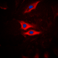 ICC/IF analysis of formalin-fixed HeLa cells using GTX32342 PLA2G4A (phospho Ser505) antibody. Red : Primary antibody Blue : DAPI Permeabilization : 0.1% Triton X-100 in TBS for 5-10 minutes ICC/IF analysis of formalin-fixed HeLa cells using GTX32342 PLA2G4A (phospho Ser505) antibody. Red : Primary antibody Blue : DAPI Permeabilization : 0.1% Triton X-100 in TBS for 5-10 minutes