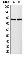 WB analysis of lambda protein phosphatase-treated HeLa (A), lambda protein phosphatase-treated NIH3T3 (B) whole cell lysates using GTX32342 PLA2G4A (phospho Ser505) antibody.