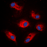 ICC/IF analysis of formalin-fixed K562 cells using GTX32352 p70 S6K (phospho Ser434) antibody. Red : Primary antibody Blue : DAPI Permeabilization : 0.1% Triton X-100 in TBS for 5-10 minutes ICC/IF analysis of formalin-fixed K562 cells using GTX32352 p70 S6K (phospho Ser434) antibody. Red : Primary antibody Blue : DAPI Permeabilization : 0.1% Triton X-100 in TBS for 5-10 minutes