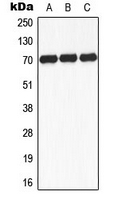 WB analysis of insulin-treated K562 (A), mouse brain (B), rat brain (C) whole cell lysates using GTX32352 p70 S6K (phospho Ser434) antibody.