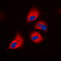 ICC/IF analysis of formalin-fixed HepG2 cells using GTX32353 p70 S6K (phospho Thr444) antibody. Red : Primary antibody Blue : DAPI Permeabilization : 0.1% Triton X-100 in TBS for 5-10 minutes ICC/IF analysis of formalin-fixed HepG2 cells using GTX32353 p70 S6K (phospho Thr444) antibody. Red : Primary antibody Blue : DAPI Permeabilization : 0.1% Triton X-100 in TBS for 5-10 minutes
