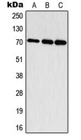 WB analysis of EGF-treated HepG2 (A), mouse brain (B), rat brain (C) whole cell lysates using GTX32353 p70 S6K (phospho Thr444) antibody.
