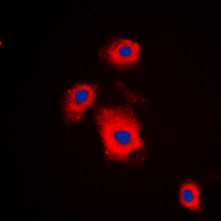 ICC/IF analysis of formalin-fixed A549 cells using GTX32354 p70 S6K (phospho Ser447) antibody. Red : Primary antibody Blue : DAPI Permeabilization : 0.1% Triton X-100 in TBS for 5-10 minutes ICC/IF analysis of formalin-fixed A549 cells using GTX32354 p70 S6K (phospho Ser447) antibody. Red : Primary antibody Blue : DAPI Permeabilization : 0.1% Triton X-100 in TBS for 5-10 minutes