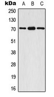 WB analysis of EGF-treated A549 (A), mouse brain (B), rat brain (C) whole cell lysates using GTX32354 p70 S6K (phospho Ser447) antibody.