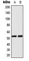 WB analysis of Actinomycin-treated MCF7 (A), Jurkat (B) whole cell lysates using GTX32360 p53 (phospho Ser33) antibody. WB analysis of Actinomycin-treated MCF7 (A), Jurkat (B) whole cell lysates using GTX32360 p53 (phospho Ser33) antibody.