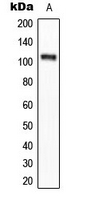 WB analysis of Calyculin A-treated HeLa (A) whole cell lysates using GTX32365 eEF-2K (phospho Ser366) antibody.