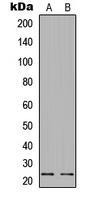 WB analysis of Forskolin-treated HeLa (A), MCF7 (B) whole cell lysates using GTX32370 Bad (phospho Ser112) antibody.