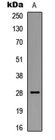 WB analysis of UV-treated HEK293T (A) whole cell lysates using GTX32372 Bcl-2 (phospho Ser87) antibody.