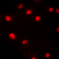 ICC/IF analysis of formalin-fixed HeLa cells using GTX32376 p21 Cip1 (phospho Thr145) antibody. Red : Primary antibody Blue : DAPI Permeabilization : 0.1% Triton X-100 in TBS for 5-10 minutes ICC/IF analysis of formalin-fixed HeLa cells using GTX32376 p21 Cip1 (phospho Thr145) antibody. Red : Primary antibody Blue : DAPI Permeabilization : 0.1% Triton X-100 in TBS for 5-10 minutes