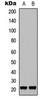 WB analysis of EGF-treated HT1080 (A), EGF-treated HeLa (B) whole cell lysates using GTX32376 p21 Cip1 (phospho Thr145) antibody.