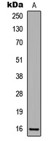 WB analysis of UV-treated HeLa (A) whole cell lysates using GTX32378 CDKN2A / p16INK4a (phospho Ser326) antibody.