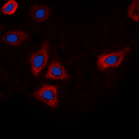 ICC/IF analysis of formalin-fixed HEK293T cells using GTX32385 EGFR (phospho Thr669) antibody. Red : Primary antibody Blue : DAPI Permeabilization : 0.1% Triton X-100 in TBS for 5-10 minutes ICC/IF analysis of formalin-fixed HEK293T cells using GTX32385 EGFR (phospho Thr669) antibody. Red : Primary antibody Blue : DAPI Permeabilization : 0.1% Triton X-100 in TBS for 5-10 minutes