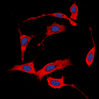 ICC/IF analysis of formalin-fixed MCF7 cells using GTX32389 Her4 / ErbB4 (phospho Tyr1284) antibody. Red : Primary antibody Blue : DAPI Permeabilization : 0.1% Triton X-100 in TBS for 5-10 minutes ICC/IF analysis of formalin-fixed MCF7 cells using GTX32389 Her4 / ErbB4 (phospho Tyr1284) antibody. Red : Primary antibody Blue : DAPI Permeabilization : 0.1% Triton X-100 in TBS for 5-10 minutes