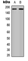 WB analysis of MCF7 (A), EGF-treated A431 (B) whole cell lysates using GTX32389 Her4 / ErbB4 (phospho Tyr1284) antibody.