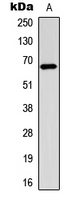 WB analysis of EGF-treated MCF7 (A) whole cell lysates using GTX32390 Estrogen Receptor alpha (phospho Ser106) antibody.
