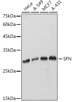 WB analysis of various sample lysates using GTX32418 14-3-3 sigma antibody. Dilution : 1:1000 Loading : 25microg per lane