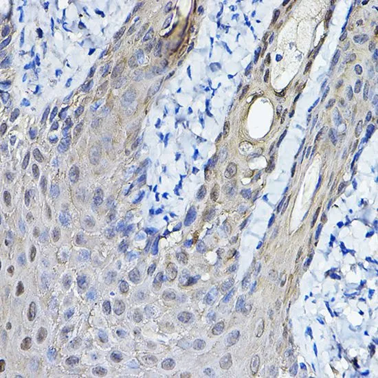 IHC-P analysis of human skin tissue using GTX32418 14-3-3 sigma antibody. Dilution : 1:100
