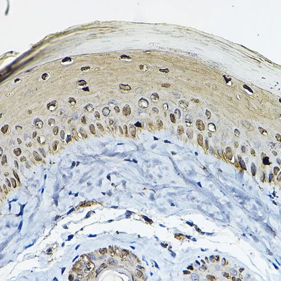 IHC-P analysis of mouse skin tissue using GTX32418 14-3-3 sigma antibody. Dilution : 1:100