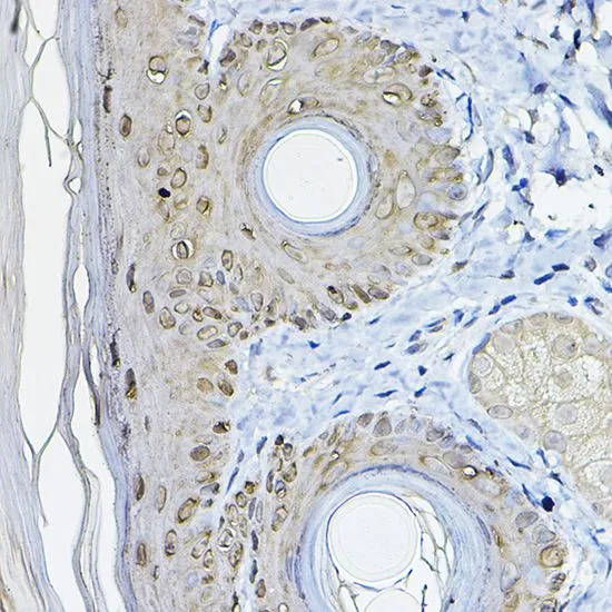 IHC-P analysis of rat skin tissue using GTX32418 14-3-3 sigma antibody. Dilution : 1:100