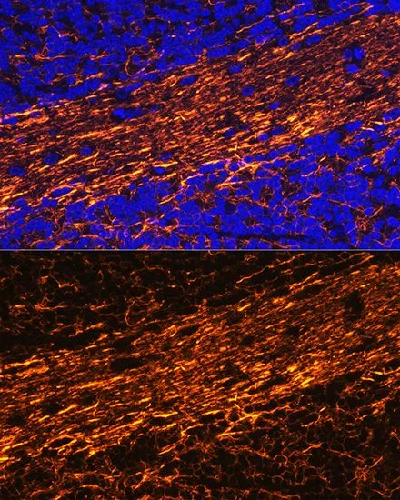 IHC-P analysis of mouse brain tissue using GTX32419 NF-L antibody. Blue : DAPI Dilution : 1:100