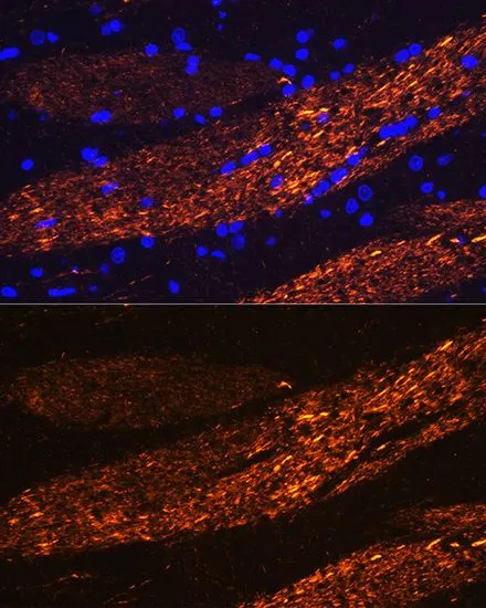 IHC-P analysis of rat brain tissue using GTX32419 NF-L antibody. Blue : DAPI Dilution : 1:100