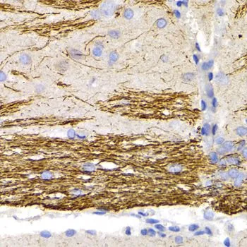 IHC-P analysis of rat brain tissue using GTX32419 NF-L antibody. Dilution : 1:200
