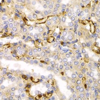 IHC-P analysis of rat kidney tissue using GTX32419 NF-L antibody. Dilution : 1:200