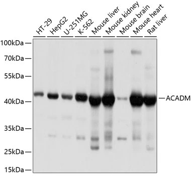 WB analysis of various sample lysates using GTX32421 ACADM antibody. Dilution : 1:1000 Loading : 25microg per lane WB analysis of various sample lysates using GTX32421 ACADM antibody. Dilution : 1:1000 Loading : 25microg per lane