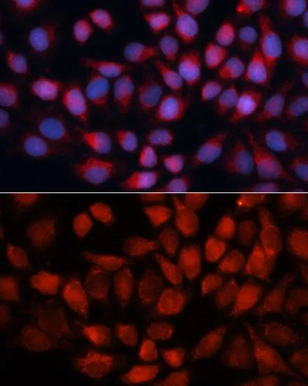 ICC/IF analysis of HeLa cells using GTX32421 ACADM antibody. Blue : DAPI Dilution : 1:100