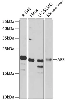WB analysis of various sample lysates using GTX32426 AES antibody. Dilution : 1:1000 Loading : 25microg per lane WB analysis of various sample lysates using GTX32426 AES antibody. Dilution : 1:1000 Loading : 25microg per lane