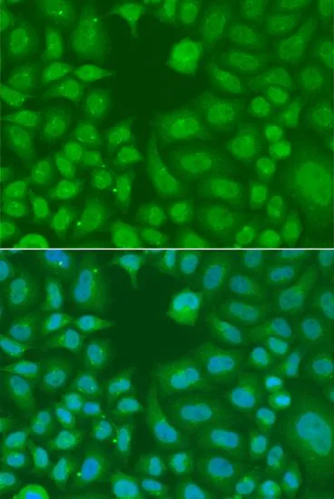 ICC/IF analysis of A549 cells using GTX32426 AES antibody. Blue : DAPI