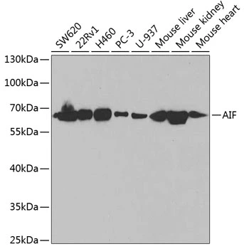 WB analysis of various sample lysates using GTX32428 AIF antibody. Dilution : 1:1000 Loading : 25microg per lane