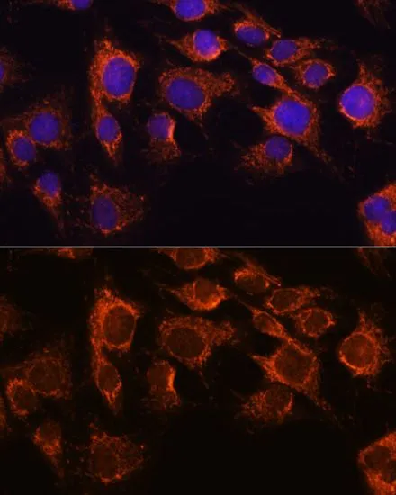 ICC/IF analysis of C6 cells using GTX32428 AIF antibody. Blue : DAPI Dilution : 1:100