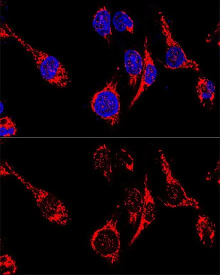 ICC/IF analysis of HeLa cells using GTX32428 AIF antibody. Blue : DAPI Dilution : 1:200